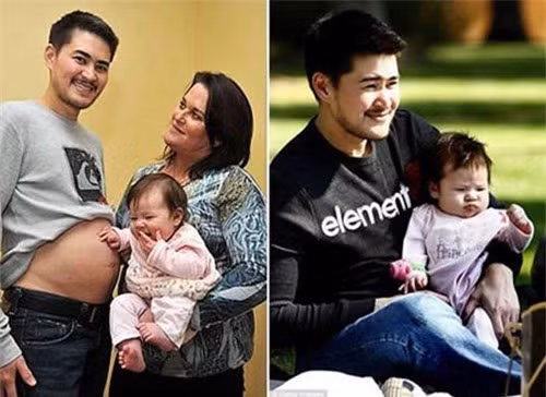 10. Người đàn ông đầu tiên làm mẹ: Ca sinh này vô cùng đặc biệt! Có lẽ đây là lần đầu tiên các bác sỹ đỡ đẻ nhìn thấy 1 người đàn ông nằm trên giường đẻ. Người "đàn ông" đó là anh Thomas Beatie, người Mỹ. Thực ra Thomas vốn là phụ nữ đã phẫu thuật chuyển đổi giới tính cách đây hơn 10 năm khi anh 20 tuổi, nhưng vẫn chưa cắt bỏ dạ con vì vậy vẫn có thể sinh con được. Không chỉ sinh con 1 lần, Thomas đã sinh tới 3 lần trong 3 năm từ 2008 đến 2010. Tất cả những ca sinh của Thomas đều nhờ tinh trùng hiến tặng.