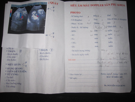 Kết quả siêu âm của sản phụ Huyền tại một phòng khám tư vào ngày 6/11. Ảnh: SKCĐ