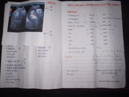 Kết quả siêu âm của sản phụ Huyền tại một phòng khám tư vào ngày 6/11. Ảnh: SKCĐ