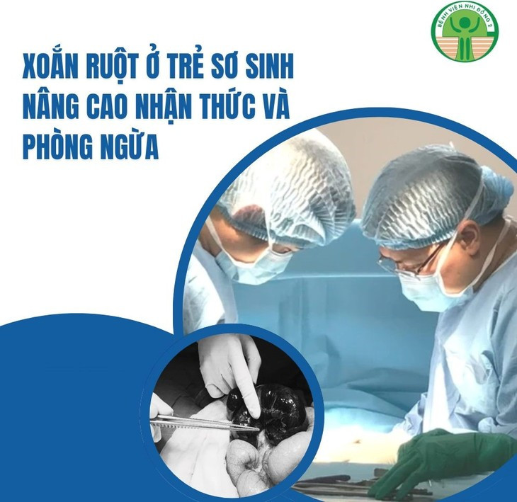 Phẫu thuật cắt ruột cho trẻ bị xoắn hoại tử - Ảnh BVCC