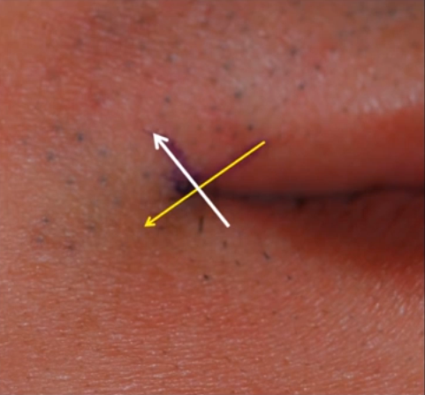 Khóe miệng sẽ được kéo lên theo hình mũi tên màu trắng.