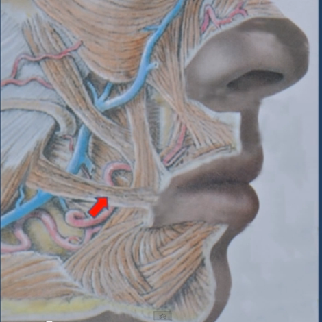 Với hiệu quả mà nó mang lại, dù chứa nhiều nguy hiểm nhưng loại hình phẫu thuật độc đáo này vẫn được nhiều phụ nữ Hàn yêu thích.