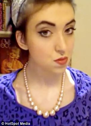 Tình trạng hàm dưới nhô ra quá mức ảnh hưởng đến Leanne sau khi cô sử dụng niềng răng năm 11 tuổi.