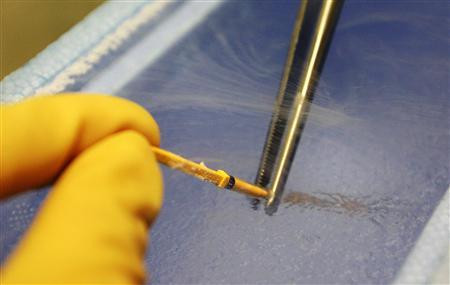 Một nhân viên y tế đang thực hiện làm đông lạnh trứng bằng nito lỏng.