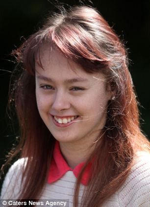 Emma cho biết da khô và bong chóc gây cảm giác ngứa, đau, hai chị em phải bôi em dưỡng toàn thân hàng ngày.