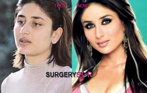 Ngôi sao Kareena Kapoor của Ấn Độ đã từng thực hiện nhiều ca phẫu thuật thẩm mỹ tại quê hương mình