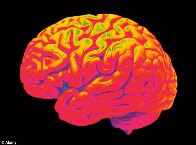 Chứng đau nửa đầu ảnh hưởng từ 10 đến 15% dân số trên thế giới.