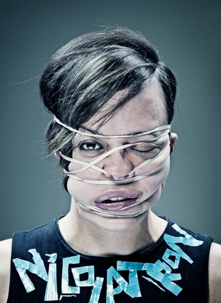 Cô gái này hẳn sẽ có một khuôn mặt xinh đẹp nếu không bị biến dạng bởi dây cao su.