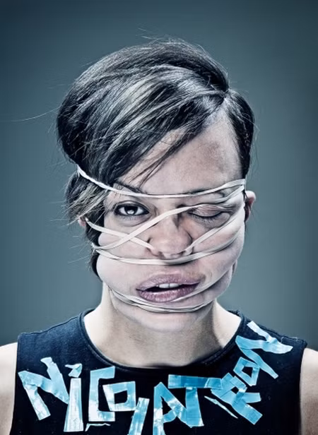 Cô gái này hẳn sẽ có một khuôn mặt xinh đẹp nếu không bị biến dạng bởi dây cao su.