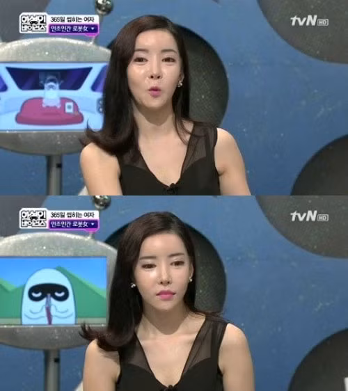 Cô Kim Ji Ahn đã thực hiện phẫu thuật thẩm mỹ đến 40 lần.