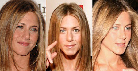 Nữ diễn viên Jennifer Aniston không phủ nhận việc cô đã hai lần phẫu thuật mũi để "chỉnh sửa một vách ngăn bị lệch", nhưng một số người nghĩ cô nghiện phẫu thuật thẩm mỹ. Có ý kiến nói rằng Jen liên tục phẫu thuật mặt, thậm chí còn nâng ngực vào năm 2010.