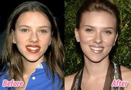 Với một chút chỉnh sửa ở chiếc mũi nở, cô ca sĩ, diễn viên người Mỹ Scarlett Johansson trông càng trở nên quyến rũ hơn.