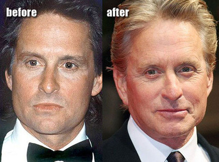Michael Douglas đã gần 70 tuổi và nếu xem ông phải trải qua rất nhiều điều trong vài năm qua (chiến đấu chống ung thư, vợ phải nhập viện vì rối loạn lưỡng cực, con trai đi tù...), chúng ta sẽ thấy ông rất tuyệt. Phẫu thuật mặt nhưng không xóa bỏ hết các nếp nhăn quyến rũ khiến cho ông đẹp tự nhiên hơn, phù hợp với một ngôi sao Hollywood đã có tuổi.