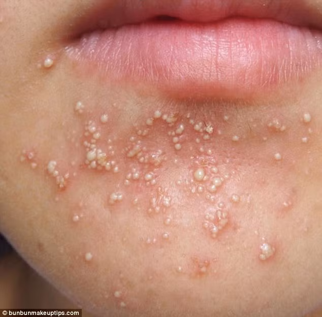 Ngày thứ 4: Những tưởng gương mặt đã khá hơn hôm qua, nhưng Juli đã hoàn toàn sai lầm.