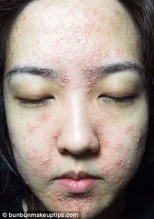 Khát khao có 1 làn da mịn màng, trắng sáng hơn, Juli đã nhận lời mời chăm sóc da tại 1 salon, vừa để làm đẹp cho bản thân, vừa giúp salon đánh bóng tên tuổi. Tuy nhiên, Juli không thể tưởng tượng nổi kết quả của quá trình làm đẹp lại xảy đến kinh hoàng như vậy.