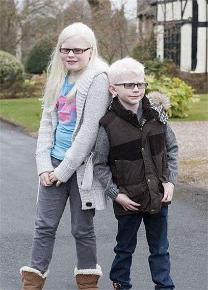 Tuy nhiên, một biến cố đã đến với gia đình của cô Lisa khi 2 đứa trẻ nhỏ vừa chào đời đã được chẩn đoán mắc chứng bệnh bạch tạng, người con lớn thì phát triển bình thường khoẻ mạnh.