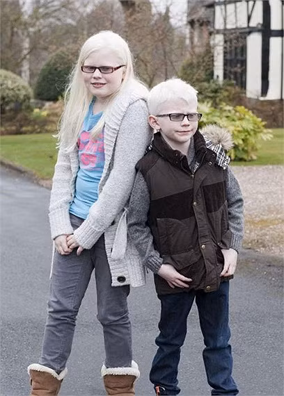 Tuy nhiên, một biến cố đã đến với gia đình của cô Lisa khi 2 đứa trẻ nhỏ vừa chào đời đã được chẩn đoán mắc chứng bệnh bạch tạng, người con lớn thì phát triển bình thường khoẻ mạnh.