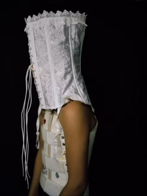 Tật vẹo cột sống bẩm sinh và sự đau đớn đã cướp mất tuổi thơ của Hannah.