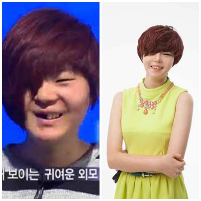 Công nghệ phẫu thuật thẩm mỹ đã biến khuôn mặt dị dạng thành mỹ nhân.