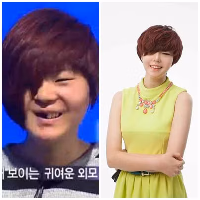 Công nghệ phẫu thuật thẩm mỹ đã biến khuôn mặt dị dạng thành mỹ nhân.