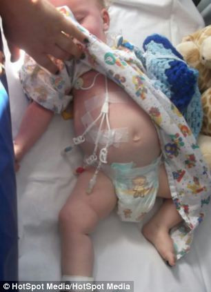 Bé đã phải trải qua 17 lần nhiễm trùng phổi sau khi ghép tủy xương.