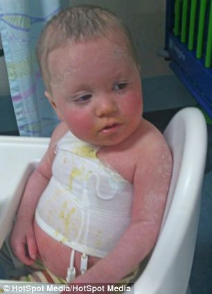 Các bác sĩ cho rẳng đây là nguyên nhân gây ra hiện tượng da nhạy cảm với ánh nắng mặt trời.