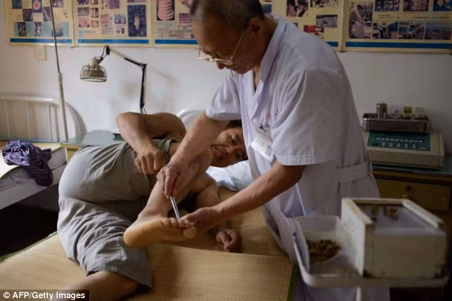 Một bệnh nhân đang được bác sĩ cho ong đốt vào chân tại một phòng khám y học cổ truyền ở ngoại ô Bắc Kinh.