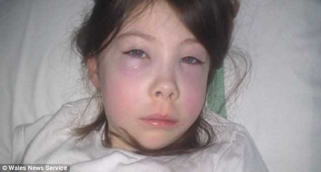 Ban đầu, bác sĩ chỉ chẩn đoán Lauryn bị ung thư máu.