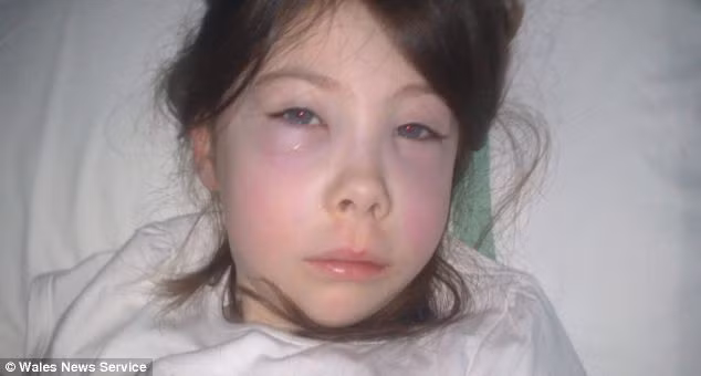 Ban đầu, bác sĩ chỉ chẩn đoán Lauryn bị ung thư máu.