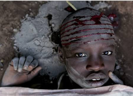 Hầu hết các bé trai, bé gái Dinka không hề rơi lệ khi các thầy phù thủy địa phương đặt con dao nóng đỏ lên khuôn mặt họ. Việc rạch mặt được thực hiện phổ biến ở Cộng hòa Sudan, và những đường nét vằn vện trên gương mặt là dấu ấn riêng của bộ tộc giúp phân biệt người của các bộ lạc khác nhau và nhấn mạnh vẻ đẹp của những người phụ nữ trong bộ lạc.