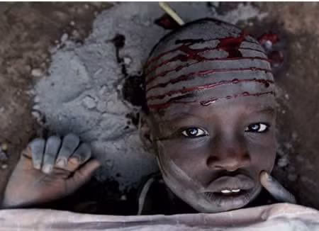 Hầu hết các bé trai, bé gái Dinka không hề rơi lệ khi các thầy phù thủy địa phương đặt con dao nóng đỏ lên khuôn mặt họ. Việc rạch mặt được thực hiện phổ biến ở Cộng hòa Sudan, và những đường nét vằn vện trên gương mặt là dấu ấn riêng của bộ tộc giúp phân biệt người của các bộ lạc khác nhau và nhấn mạnh vẻ đẹp của những người phụ nữ trong bộ lạc.