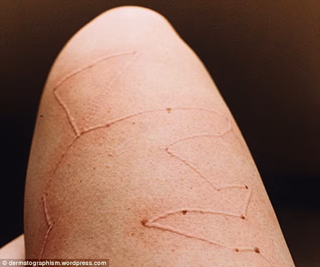 Cô sử dụng một cây kim đan cùn để viết nên những ký tự và những hình thù trừu tượng lên vùng da ở cánh tay, chân, và mặt.