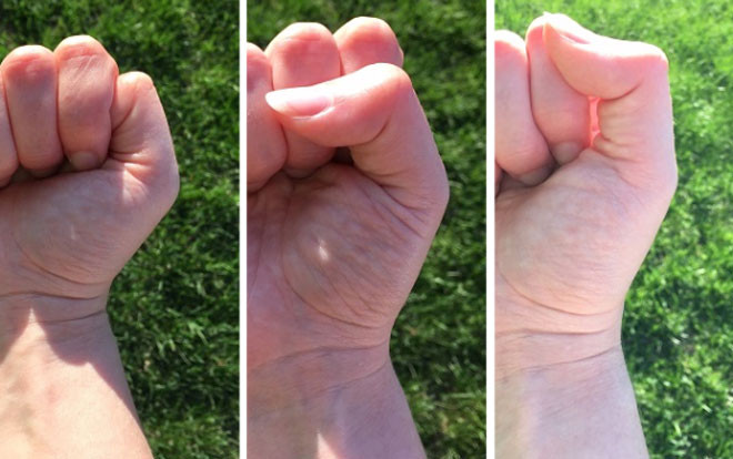 Ngón cái giấu vào trong. Kiểu nắm tay này cho thấy bạn khá vui tính, hóm hỉnh, giỏi tranh cãi, hùng biện tốt. Bạn thuộc tuýp người hướng nội, không thích giao tiếp quá nhiều. Bạn chỉ tự tin khi ở cạnh những người thân quen và dè dặt với người lạ nên khó bộc lộ được ưu điểm của mình.