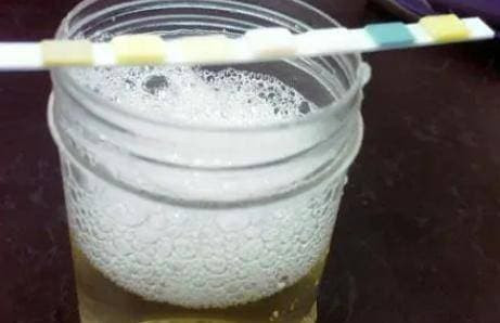 Thay 4 thay doi nay khi di tieu, kiem tra cang som cang tot-Hinh-3