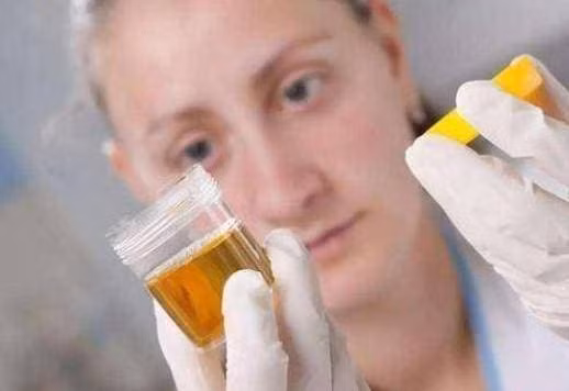 Thay 4 thay doi nay khi di tieu, kiem tra cang som cang tot-Hinh-5