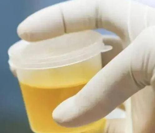 Thay 4 thay doi nay khi di tieu, kiem tra cang som cang tot-Hinh-4