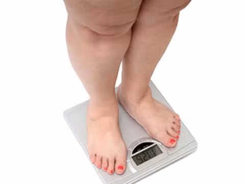 Bật đèn phòng ngủ ban đêm khiến phụ nữ dễ đối diện với nguy cơ béo phì. Ảnh minh họa.