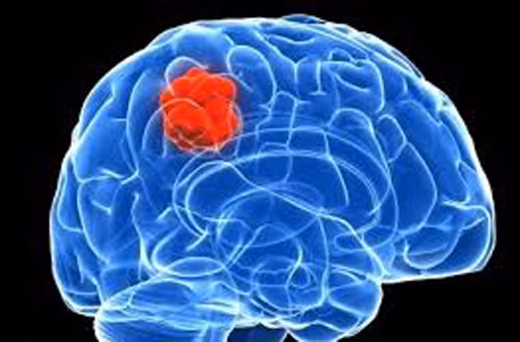 Các nhà khoa học thực hiện đối chiếu giữa 2 đối tượng và nhận thấy, những người thường xuyên làm việc với điện thoại di động có nguy cơ cao mắc bệnh về não.