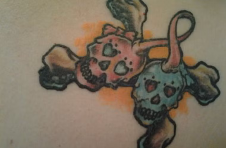 Hình ảnh cảnh báo sự nguy hiểm của căn bệnh.