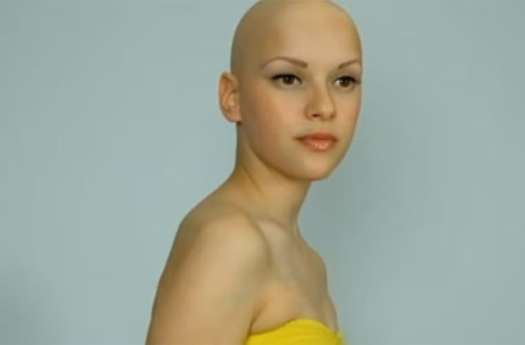 Bàn về vấn đề này, tiến sĩ David Fenton nói thêm: “Tình trạng rụng tóc ở phụ nữ đang có xu hướng gia tăng. Tuy nhiên, chúng ta chưa có đủ kinh phí nghiên cứu để tìm ra giải pháp phù hợp. Chính vì vậy, phụ nữ buộc phải che giấu nó. Tôi hy vọng trong tương lai gần, chúng ta sẽ tìm được cách khắc phục hữu hiệu”.