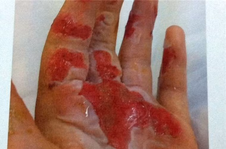 Đá khô lạnh gấp nhiều lần so với đá nước. Đây cũng là điểm khác biệt lớn giữa đá khô và đá nước thông thường. Đá khô được tạo thành từ khí CO2 trong quá trình sản xuất công nghiệp. Chúng được nén thành dạng rắn ở áp suất cao và có nhiệt độ rất thấp (khoảng - 78,5 độ C).