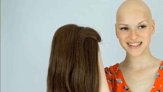 Đây là lần đầu tiên Joelle xuất hiện mà không có mái tóc giả. Thậm chí, cô còn tự tạo một clip nhạc và chia sẻ trên Youtube. Tại đây, clip nhận được 200.000 lượt xem và Joelle khẳng định mái tóc mình đang sở hữu chỉ là giả.Câu chuyện của Joelle nhanh chóng được chia sẻ trên các kênh truyền thông của nhiều nước.