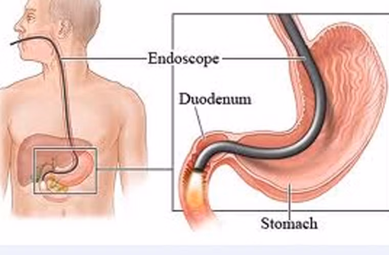 Thường xuyên khám sức khỏe. Việc thường xuyên đi khám sức khỏe cho phép sớm tìm ra nguyên nhân các triệu chứng bất thường ở dạ dày. Tại đây, các bác sĩ có thể lựa chọn nội soi dạ dày, chụp X – quang, sinh thiết, quét CT, PET hoặc MIR để phát hiện bệnh.