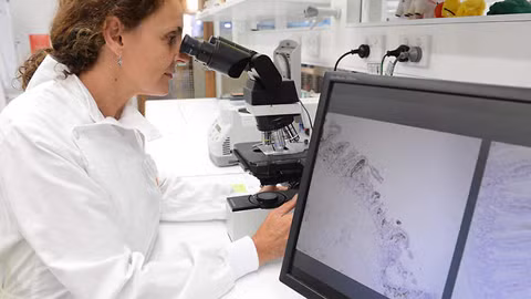 Sở hữu loại tế bào này, bệnh nhân ung thư vú có khả năng sống sau năm năm cao hơn 10% so với người không có nó.