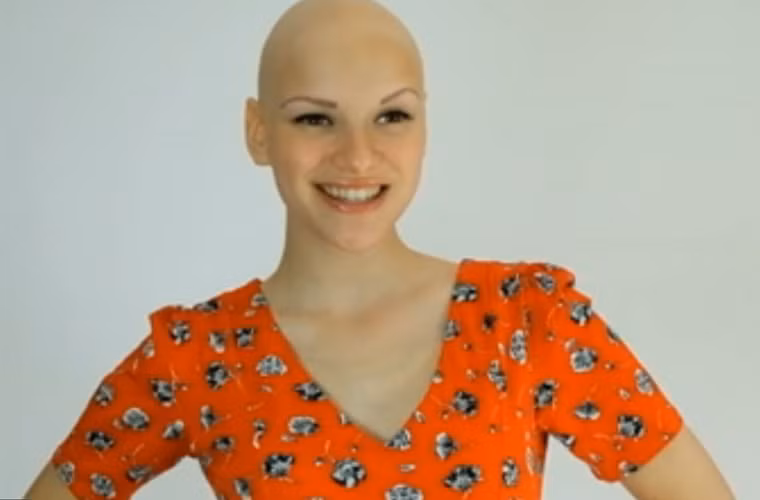 Sau thời gian dài sở hữu vẻ ngoài không giống đám đông, Joelle cho rằng mọi người nên có cái nhìn thân thiện hơn với những người như cô, đặc biệt là các bệnh nhân ung thư.