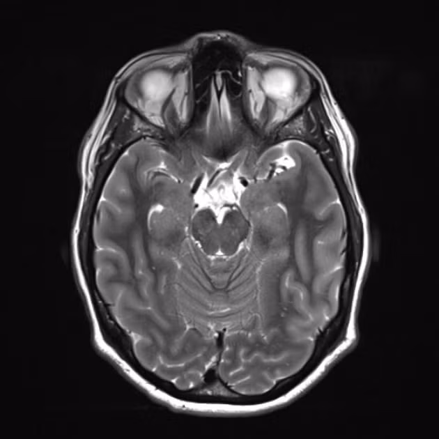 Thập niên 1940-1950, máy quét MRI ra đời, giúp các nhà y khoa chụp được hình ảnh của những cấu trúc mềm bên trong cơ thể sống.