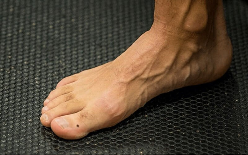 4 nốt ruồi ở bàn chân báo hiệu tài lộc vô biên, hậu vận no đủ - Hình 2 4 not ruoi o ban chan bao hieu tai loc vo bien, hau van no du-Hinh-2