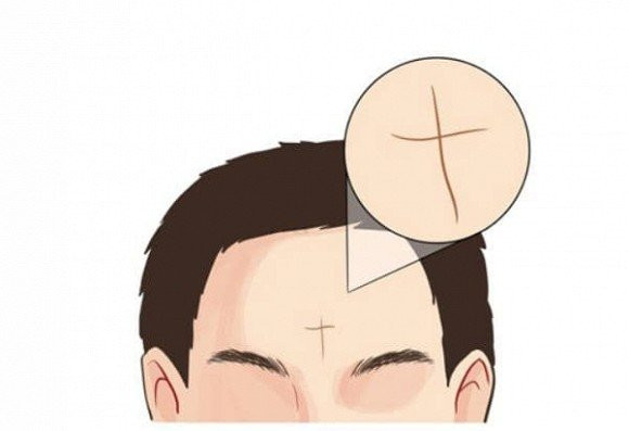 6 nét tướng trên mặt sinh ra là để hưởng vinh hoa, nét này nhìn qua đã khổ 6 net tuong tren mat sinh ra la de huong vinh hoa, net nay nhin qua da kho