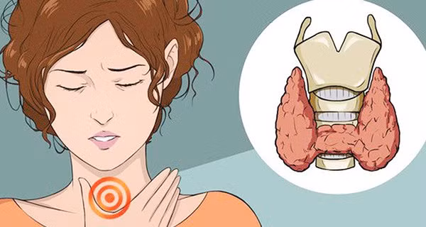 9 trieu chung canh bao K tuyen giap o phu nu: Nhieu nguoi khong biet