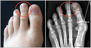 Những người này thường có khả năng trở thành nghệ sĩ hay vận động viên bởi khả năng ham mê thể thao và tính sáng tạo. Bên cạnh đó, họ có thể làm nghề doanh nhân, công an bởi bạn đủ khéo léo, sự khôn ngoan để có thể hoàn thành tốt nhiệm vụ của mình. 